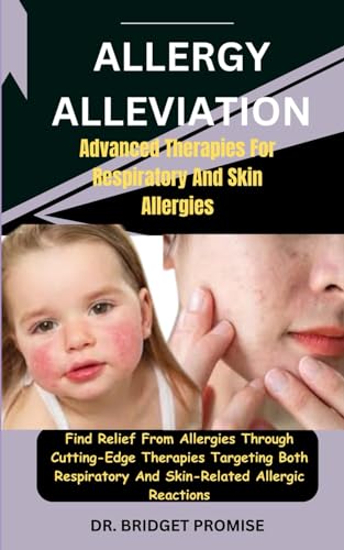 Allergy Alleviation: Advanced Therapies For Respiratory And Skin Allergies: Find Relief From Allergies Through Cutting-Edge Therapies Targeting Both Respiratory And Skin-Related Allergic Reactions von Independently published